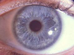 oog